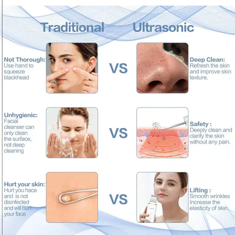 Ultrasonic Skin Scrubber – 5-in-1 Multifunctional Deep Face Cleansing Super Mall